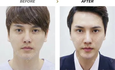 Before & After