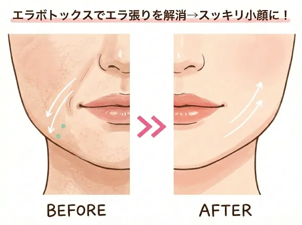 ボトックス注射の頻度・持続期間・長く維持するコツ、すべてお教えします