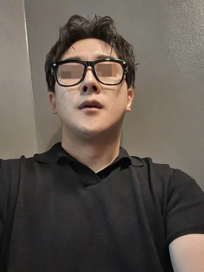 男性 / 鼻・輪郭・二重顎筋肉縛りを同時に受けました。