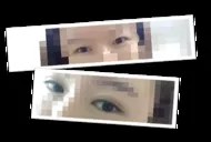 再手術だったんですよ、、、