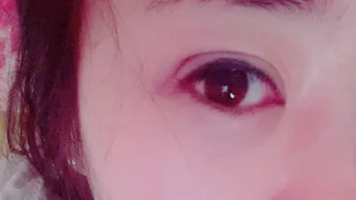 埋没から10年で全部取れちゃって…ㅠㅠ