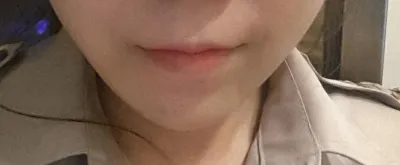 院長先生、お元気ですか？エラの手術を受けたウンジョンです。