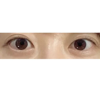 目つき矯正、すごく自然だね！