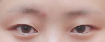 目つき矯正して1ヶ月^^