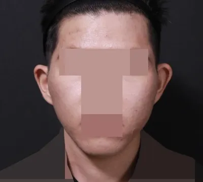 顔の形が変わるのが見えます。