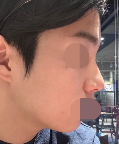 今3ヶ月ほど経ちましたが、形にとても満足して過ごしています。