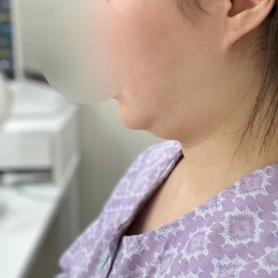 シャープなフェイスラインで、とってもとってもベリーグッドです。