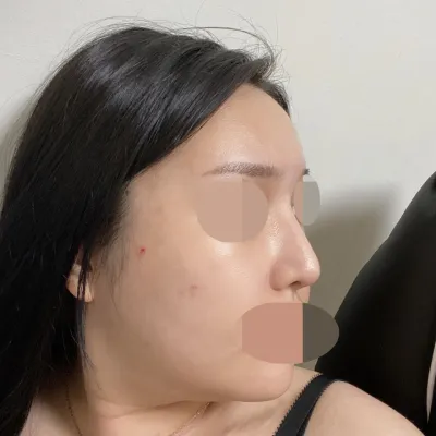 初めてギプスを外した時のラインがそのまま維持されていて、ばっちりです。