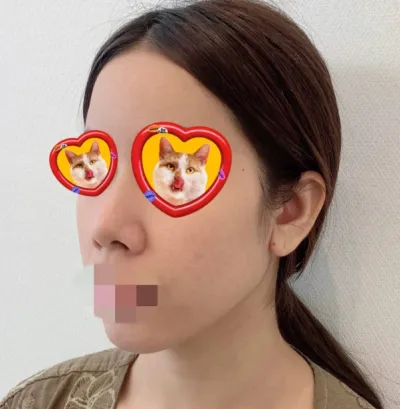 鏡を見るたびに満足していて、自信もつきました。