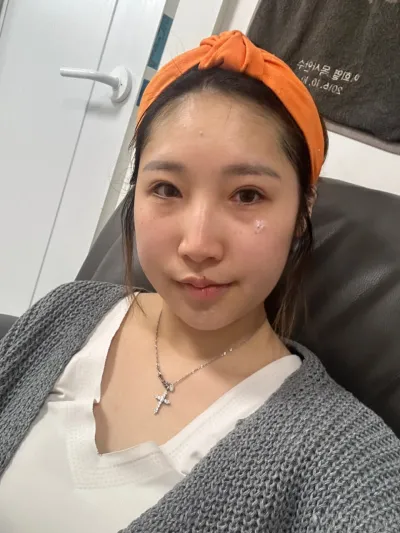 思い切って目と鼻を一緒にしたのですが、とても満足しています。