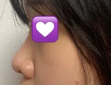 すごく綺麗になったと言われて、最近幸せな毎日を過ごしています。