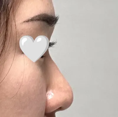 私の顔に似合うラインに仕上げてくださった気がします。