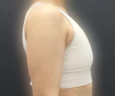 やって本当によかったと思うし、他の部位で気になるところももっと欲が出てくる。