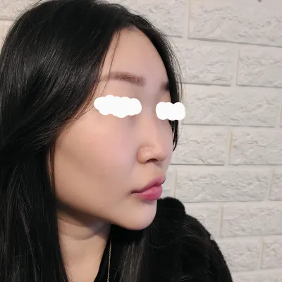 綺麗な鼻を作ってくださったイム・ヨンミン院長、鼻炎も治してくださったナム・ジェソン院長、ありがとうございます〜