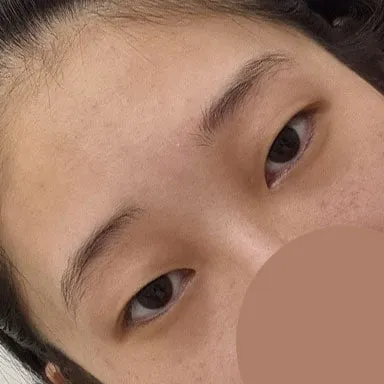 自分の目に馴染んできて、腫れも完全に引いた状態だと思います！メイクをする時の満足感が一番大きいです〜