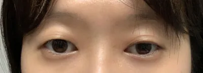 それでも結果がとても良かったので、おすすめです！！