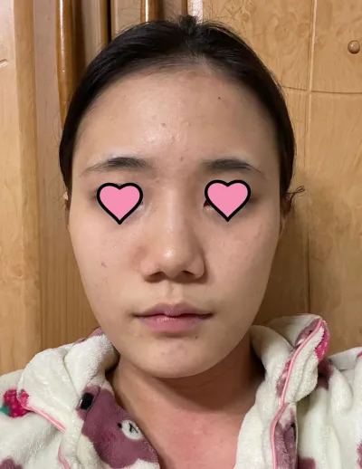 本当に私の欠点をすべて補ってくださり、完璧な鼻にしてくださって本当にありがとうございます！