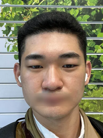 今まで生きてきた中で、人生で良い選択をしたと感じるのが整形です。