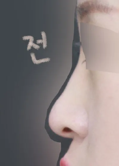 自然に手術してくださった院長先生、本当にありがとうございます！