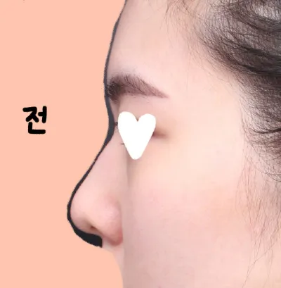 ベリーグッドで手術を悩んでいるなら、悩まずに受けてください！！！！