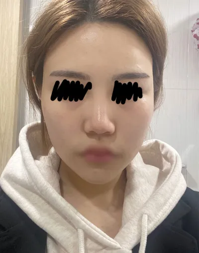 とても満足して過ごしています！！皆さんも悩むよりはgo.!