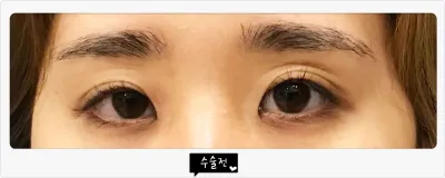 ベリーグッド整形外科のレビューです。