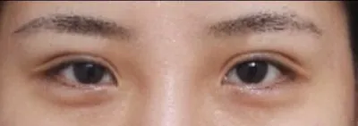 ハム目よ、もうさよなら〜