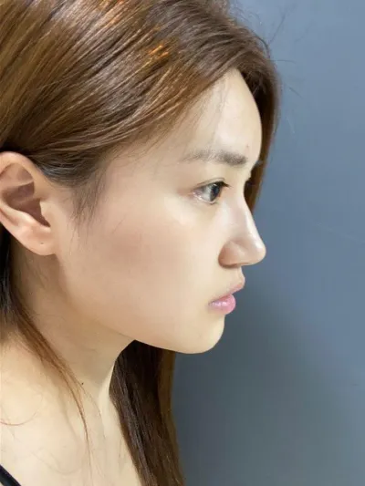 イム・ヨンミン院長と手術前後の写真を見ながら、手術がうまくいったねって相槌を打ってきましたｗｗ