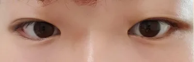 ベリーグッド整形外科のソン・ウォニル院長のレビューです。