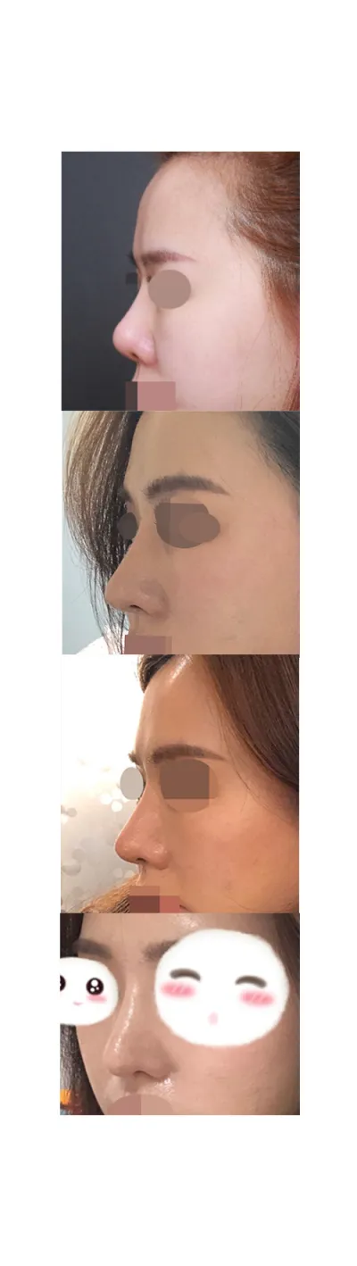 周りから自然なほうがずっといいとよく言われます。