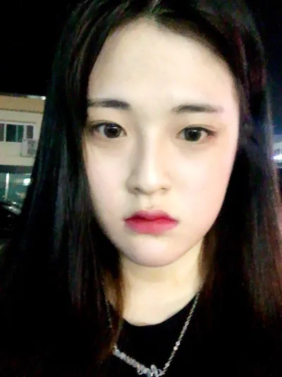 すごく幸せです〜〜〜手術してから6ヶ月経ちましたが、今では本当に本当に手術したことに気づかない人が大多数なほどです〜