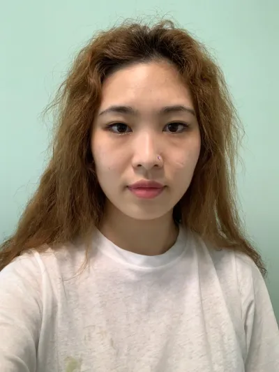 目、鼻、輪郭の手術をベリーグッドで受けました。レポ残します〜〜！！