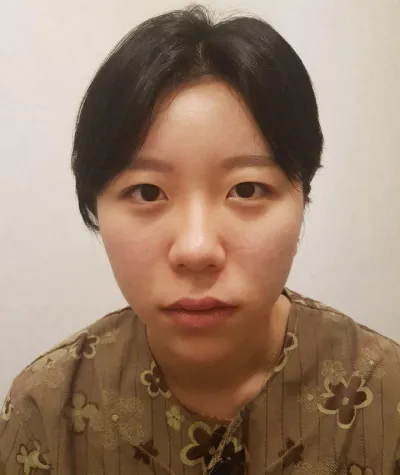 二重整形で悩んでいる方、ぜひやってください！