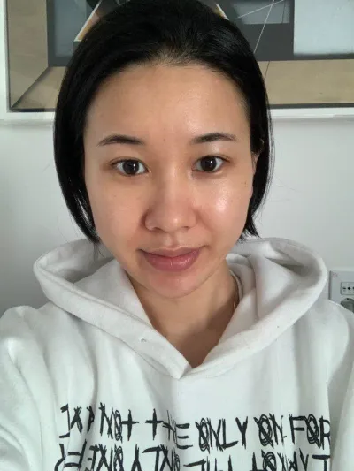 手術してからもう6ヶ月が経ちました！レポ残します〜