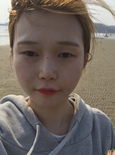 2年前にベリーグッドのイム・ヨンミン院長に目、鼻、フルフェイス脂肪移植を受けたレビューを残しに来ました。