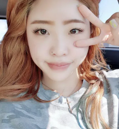 手術してから3ヶ月経ちました！腫れも全部引いたみたいです。