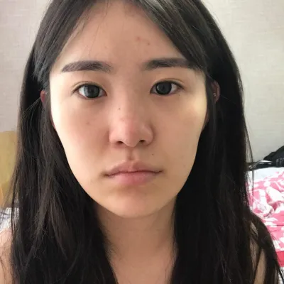 鼻の手術をしてから、もうすぐ4ヶ月になります！