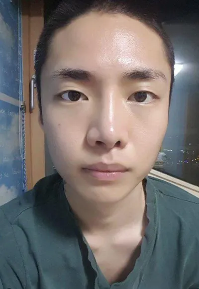 こんにちは~~ 目の手術と鼻の再手術のレポです！！