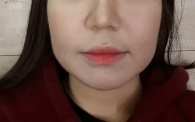 スピーディーなカウンセリング、明快なプラン、そして満足のいく施術結果を届けてくださった金俊賢院長、本当にありがとうございました！