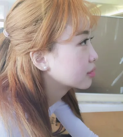 二重、自然癒着、目つき矯正、目頭・目尻・垂れ目形成、もう全部やった！