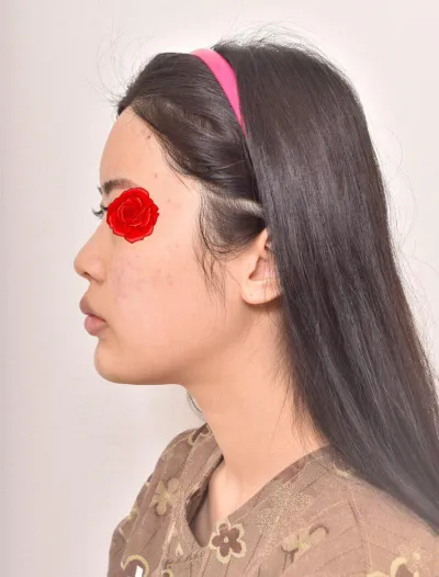 満足です！！イム・ヨンミン院長、ありがとうございましたっ！