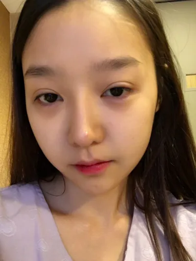 再手術、悩まずにベリーグッドで受けてください〜