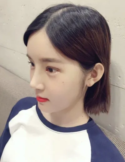 頬骨縮小2週目です！！