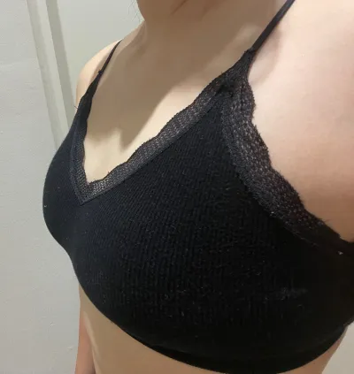 下垂修正手術 6ヶ月目