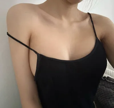 豊胸手術22日目のレポです / モティバ デミ