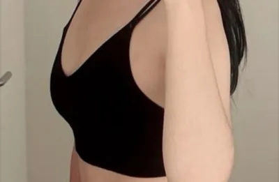 モティバ1ヶ月目レポ）金曜手術、月曜出勤！