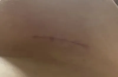 私の胸の形に合わせて正直にカウンセリングしてくださったので、予約しました☺️