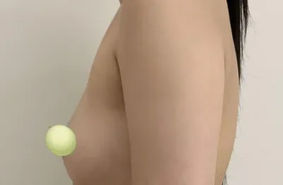 私の傷跡が一番小さくて目立ちませんww