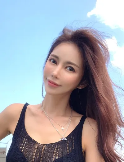 ミニフェイスリフト、脂肪移植、脂肪吸引（頬）