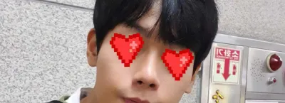 ジェイジュン整形外科で鼻の手術を受けました！（再手術ではありません）